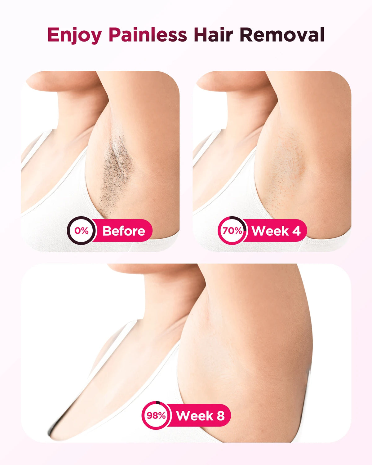 Totmizby Ipl Laser Epilator For Permanent Hair Removal